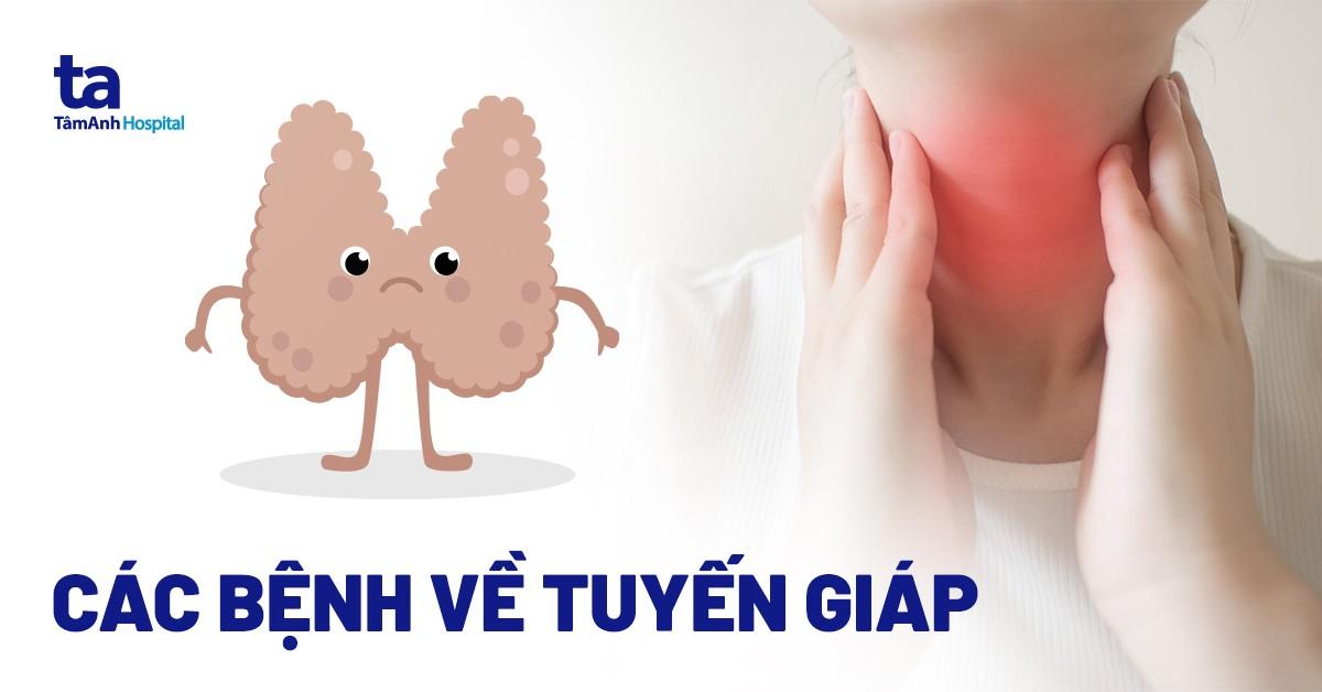 các bệnh về tuyến giáp