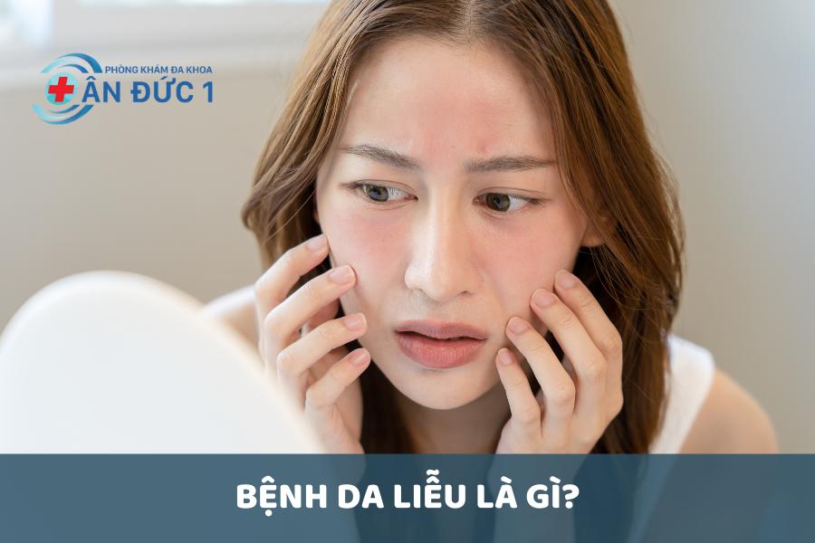 Bệnh da liễu là gì?