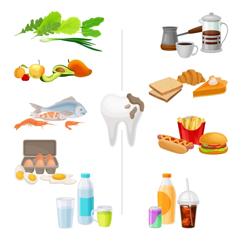 Bị đau răng kiêng ăn gì? Nên ăn khi bị đau răng