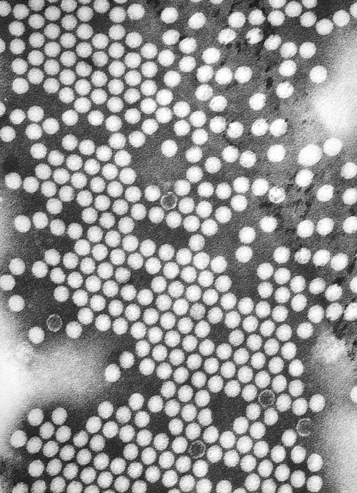 Transmission electron microscopy