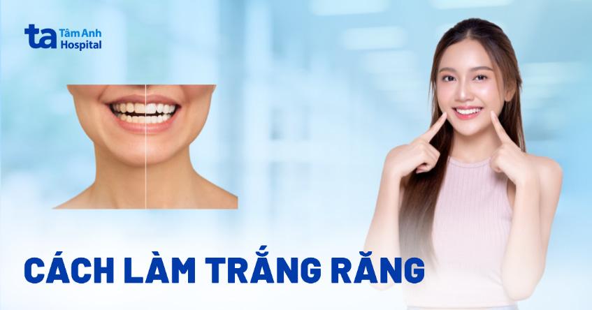 15+ cách làm trắng răng tại nhà tự nhiên, hiệu quả và tiết kiệm
