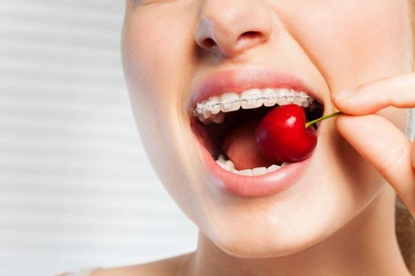 Gợi ý món ăn cho người niềng răng khoa học, đầy đủ