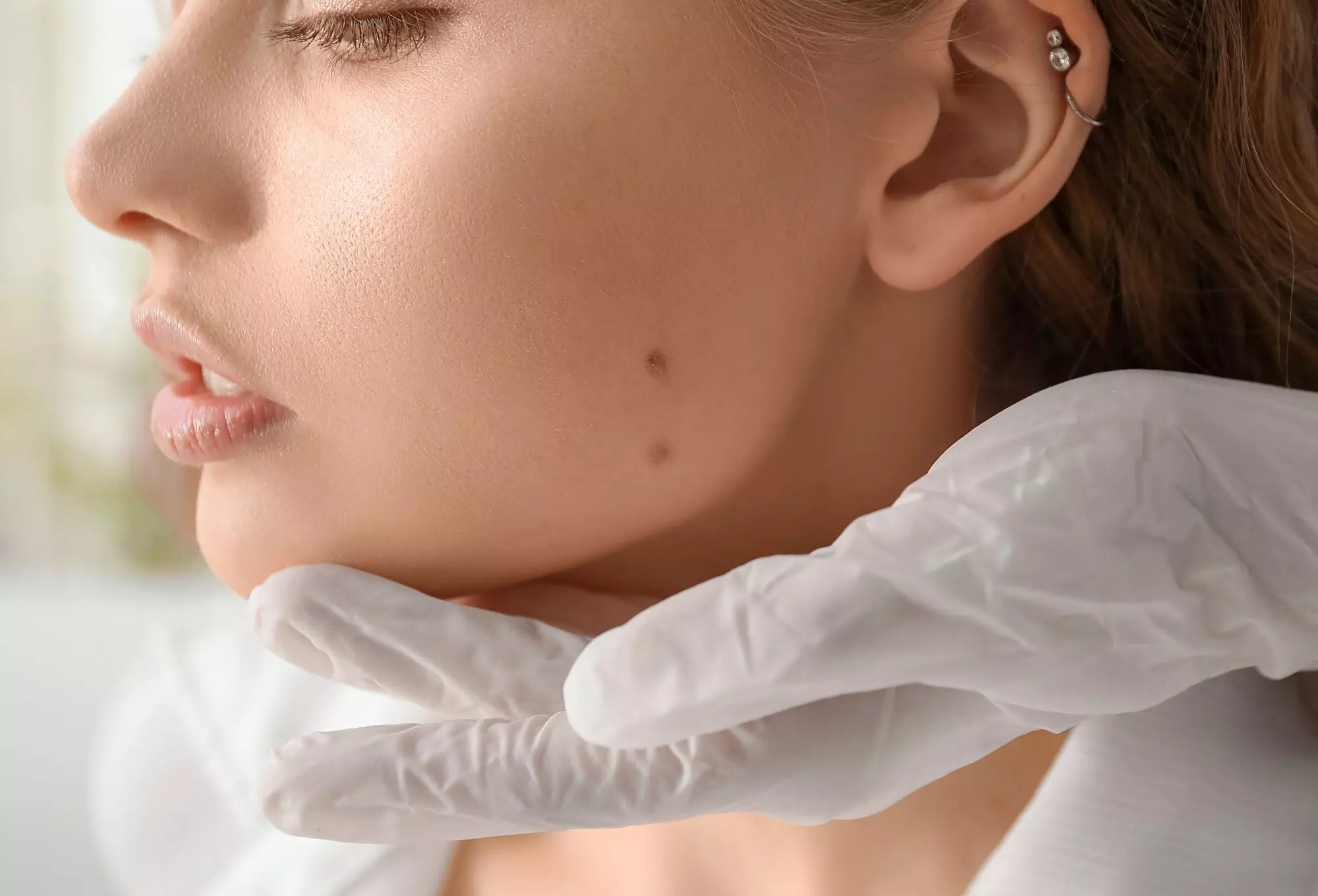Những nốt ruồi trên mặt mang lại sự may mắn